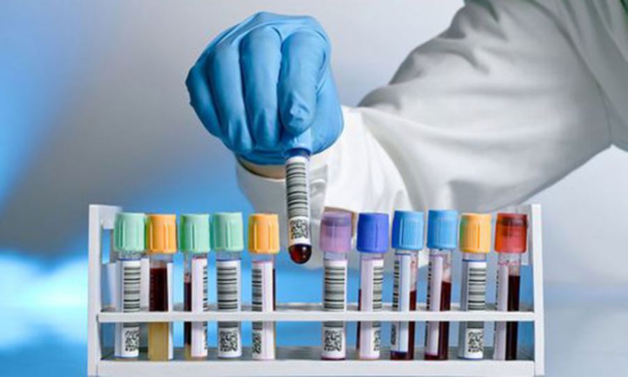 “Koronavirus laboratoriyada yetişdirilib” -     Deputatdan SENSASİON İDDİA