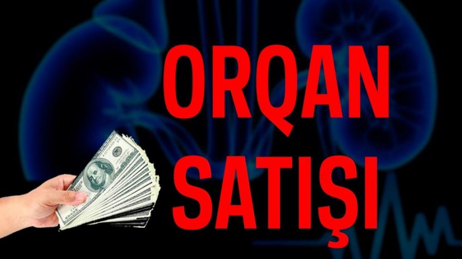 Daxili orqanlarını satışa çıxaranlar var:     Onları hansı CƏZA gözləyir?