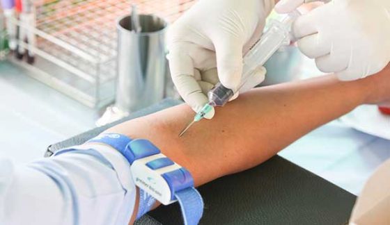 Koronavirusdan sağalmış şəxslər ağır xəstələrə donor ola bilərlər