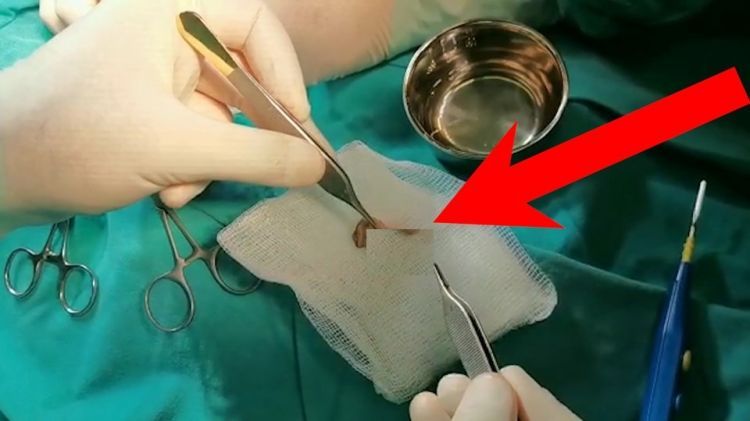 Bakıda sünnət edilən 4 aylıq körpənin ölümü ilə bağlı     TƏFƏRRÜAT