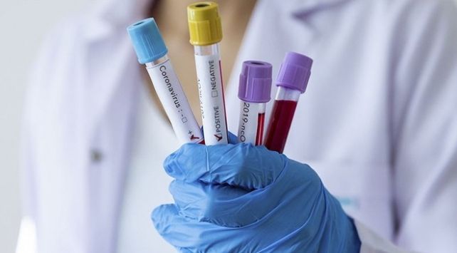 “Koronavirus üçün vaksini 3-4 ay ərzində əldə etməyi düşünürəm” -     Azərbaycanlı alim