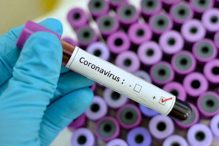 Gürcüstanda daha bir nəfər koronavirusa yoluxdu