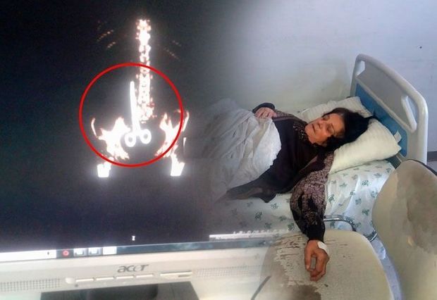 Azərbaycanda əməliyyatdan sonra xəstənin daxilində qayçı qaldı -     FOTO