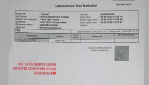 Röya koronavirusa yoluxub? -   FOTO — foto 1