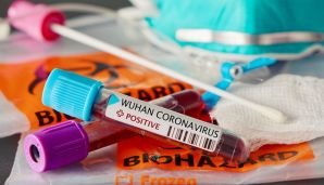 Koronavirusla mübarizənin təbii vasitəsini tapdılar -       ŞAD XƏBƏR — foto 1