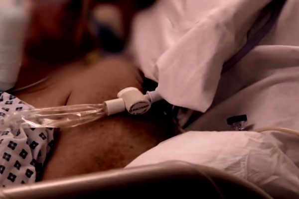 Bakıda koronavirus xəstələrinin dəhşətli görüntüləri -           VİDEO