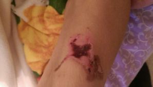 “Tibb Universitetinin klinikasında anamın onurğasını sındırdılar” -   FOTO — foto 1