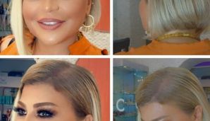 Mətanət İsgəndərli tanınmaz halda -       FOTO — foto 2