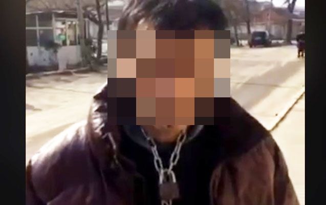Ruhi əsəb xəstəsini buna görə zəncirləyibmiş