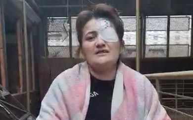 Gəncə vurulanda sol gözünü itirən qadın: “Evim dağılıb, icra başçısı məni qəbul etmir”