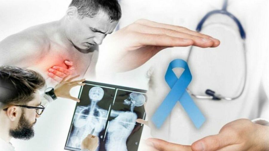 Bədəndə xərçəng yaranmasını göstərən 15 siqnal –     Görməzdən gəlməyin