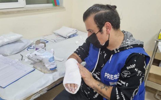 İcra başçısına məxsus restoranda çəkiliş aparan jurnalistin qolu sındırıldı -       FOTO