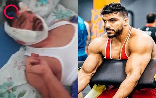 Partlayışda ağır xəsarət alan çempionun xəstəxanadan fotosu