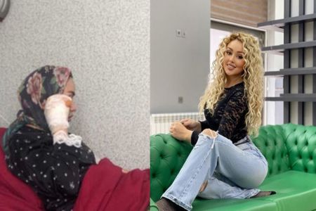 "Gecə klubuna sahura getmişdim" -     Bardakı partlayışda yaralanan qız