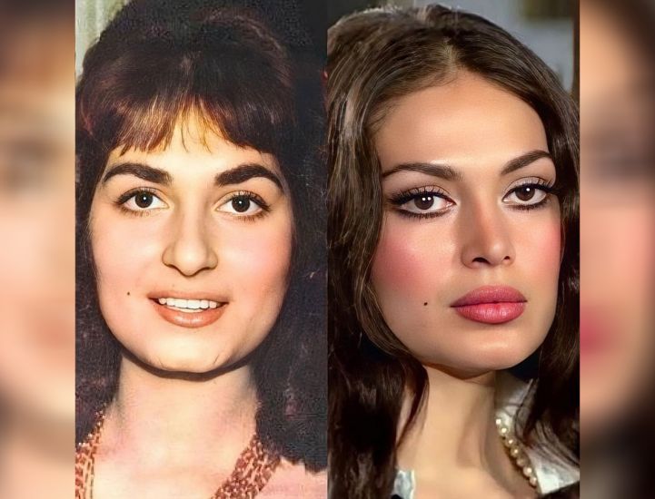 Türkan Şorayı dəyişdirən plastik əməliyyatlar və qiymətləri -       FOTO