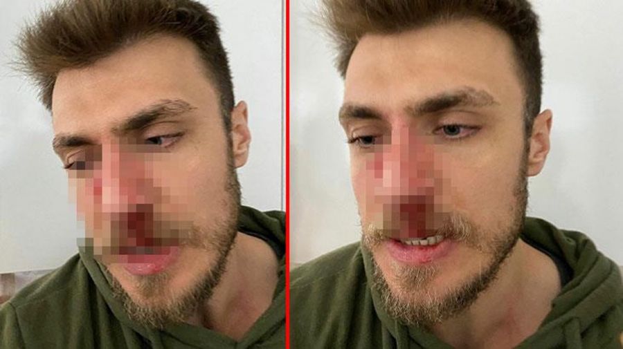 Ər kişi ginekoloqu döydü: Arvadıma niyə baxırsan?
