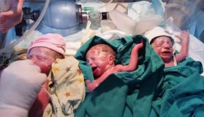 Bakıda koronavirusa yoluxan hamilələrdən biri üçəm, digəri dördəm dünyaya gətirib -   FOTO — foto 1