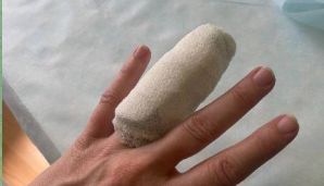 Zaxarovanın barmağı qırıldı -       FOTO — foto 1