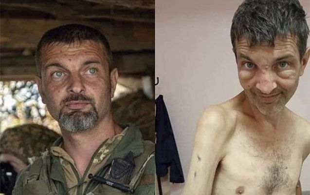 4 ay Rusiya əsirliyi “Azov döyüşçüsü”nü tanınmaz hala saldı -       FOTO