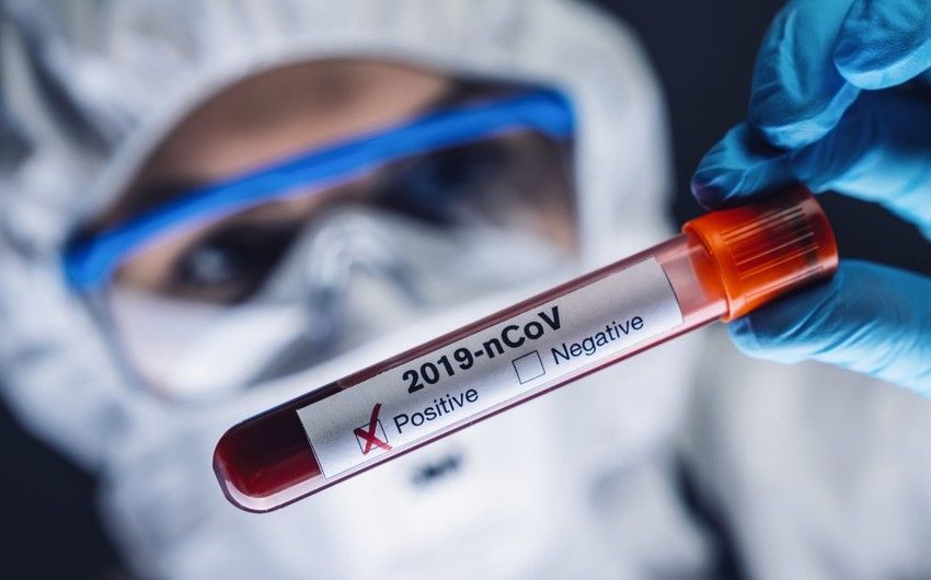 Azərbaycanda son həftədə 17 nəfər koronavirusa yoluxub, 1-i ölüb