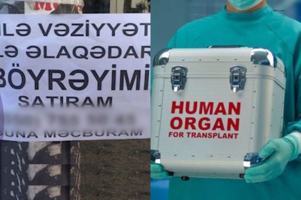Orqan satışı elanlarını yayanlar kimlərdir? -     VİDEO