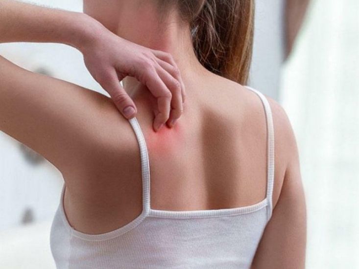 Azərbaycanda qotur yayılıb? -     Dermatoloqdan AÇIQLAMA