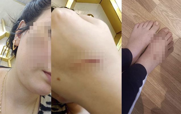 Qadını zorla maşına mindirən qohumları daha əvvəl də onu döyübmüş -     FOTOLAR