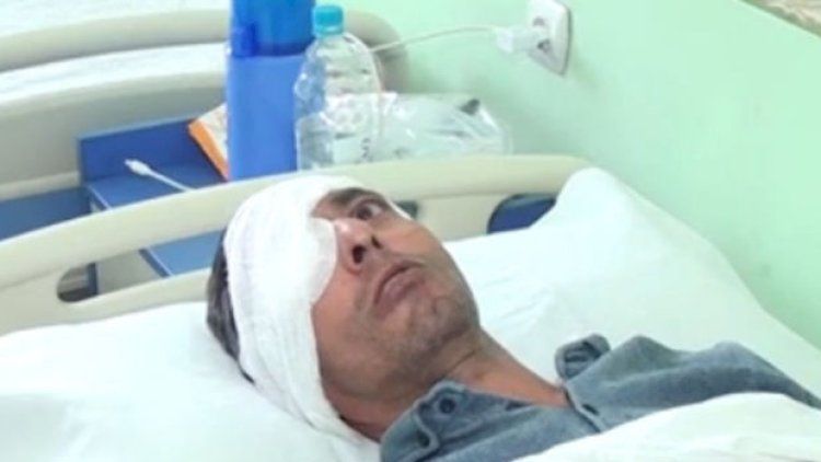 Gəncədə növbə üstündə dava düşdü:     “Gözümün pərdəsini cırıb” - VİDEO