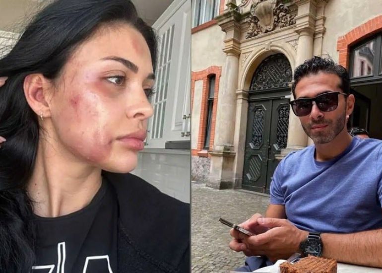 Model sevgilisini döyən Ziya Hüseynzadə cəzalandırıldı