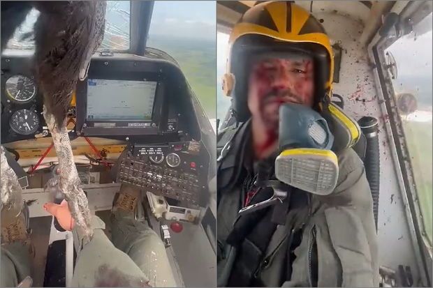 Havada dəhşət: Kabinəyə girən gözlənilməz qonaq pilotu yaraladı -     VİDEO