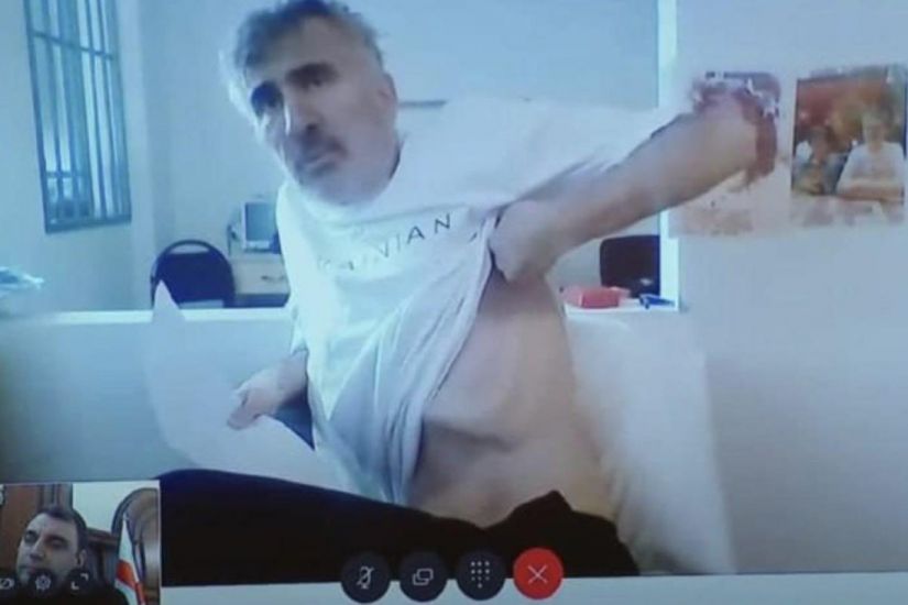 Saakaşvili ölüm ayağındadır