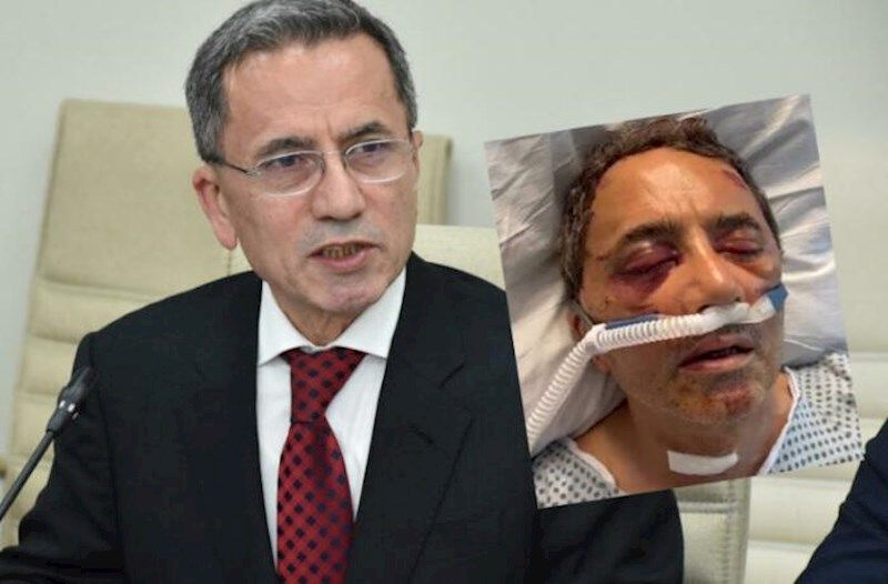 Əhməd Obalını oğlu döyüb -     SENSASİYA