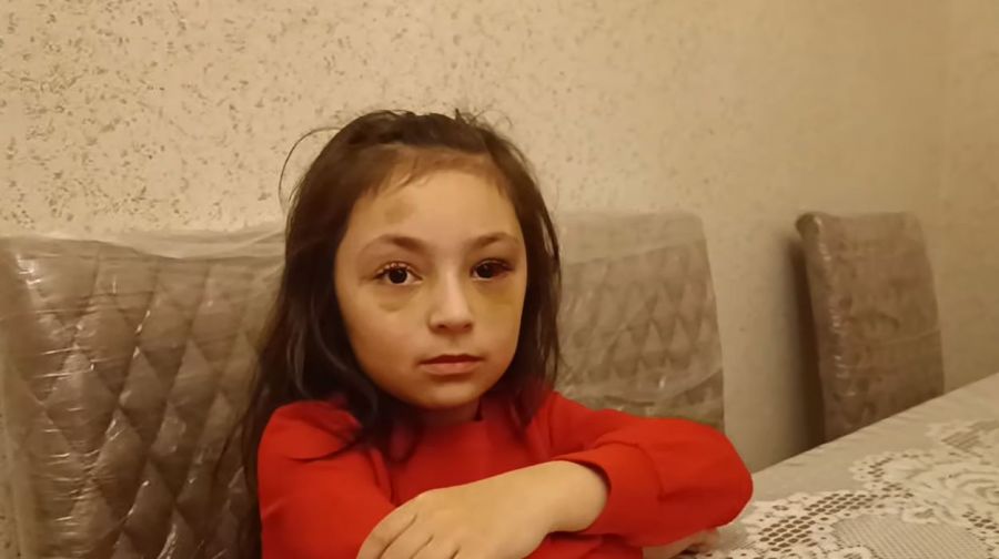 “Direktor maddiyyatla həll etmək istəyirdi” -     Döyüldüyü deyilən məktəblinin anası - VİDEO