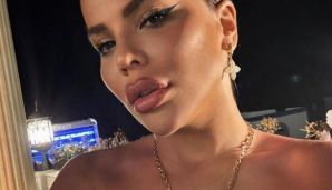 Bədəni çürüyən azərbaycanlı modelin son halı -         FOTO — foto 2