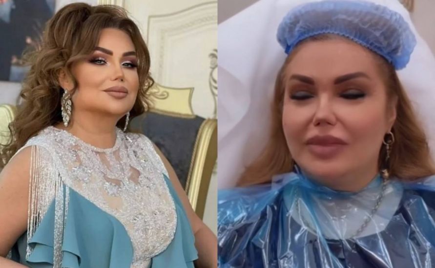 Könül Kərimova: "Heç bir plastik əməliyyat etdirməmişəm"