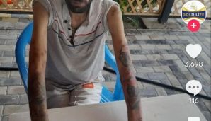 Tanınmış azərbaycanlı reperin bu halı görənləri sarsıtdı -       FOTO — foto 1