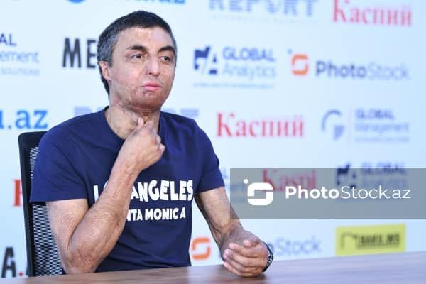 ABŞ-də 2 milyonluq təqaüd qazanan Gursel: "Alovun rəngi görünməyənə qədər yandığımı bilmədilər"