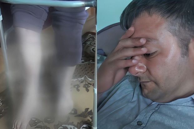 Fiziki məhdudiyyətli şəxsə əlillik təyin edilmir: “Məni get-gələ salıblar” -     VİDEO