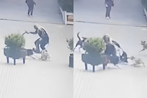 Xırdalanda it dişləyən qadın DANIŞDI: “Ayağımdan əti qopardı” -     VİDEO