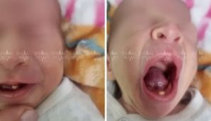 Qubada qeyri-adi körpə doğuldu -       FOTO — foto 1