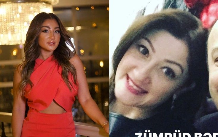 Zümrüdün estetiksiz görüntüsünü paylaşdı -       FOTO
