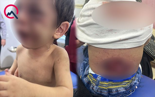 Narkotik basqınına gedən polislər dəhşət yaşadılar -     Azərbaycanda ŞOK - FOTO