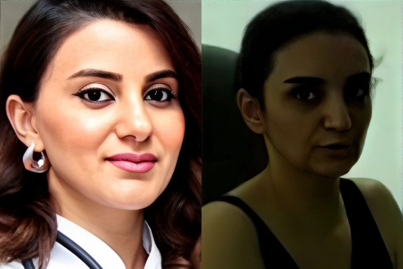 Prokuror "Talassemiya işi"nə görə təqsirləndirilənlərə ağır cəza istədi