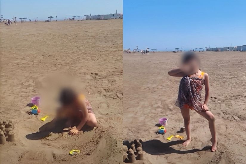8 yaşlı qızın bədənində siqaret söndürüblər? -       İddiada adı hallanan ana DANIŞDI