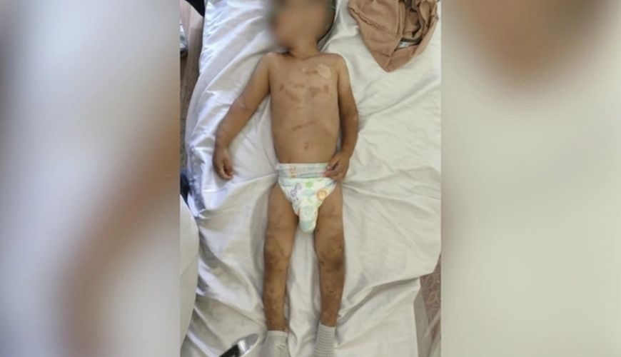 Ombudsmandan Ağdamdakı hadisə ilə bağlı     AÇIQLAMA