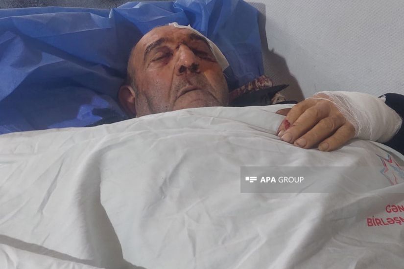 Samuxda oğul 84 yaşlı atasına balta ilə xəsarət yetirib -