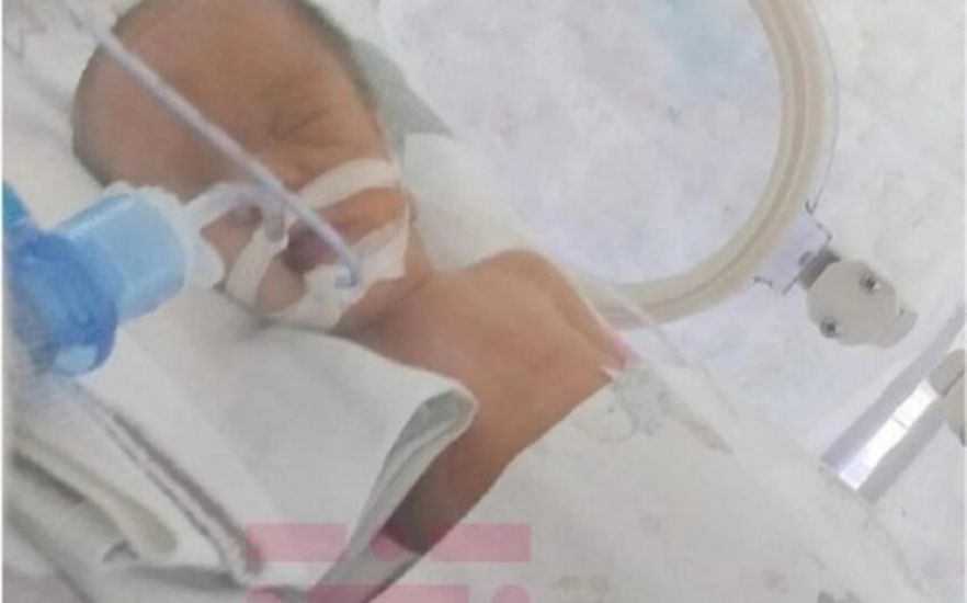 Bakıda üçəmlərdən ikisi xəstəxanada öldü, valideyn həkimləri günahlandırır